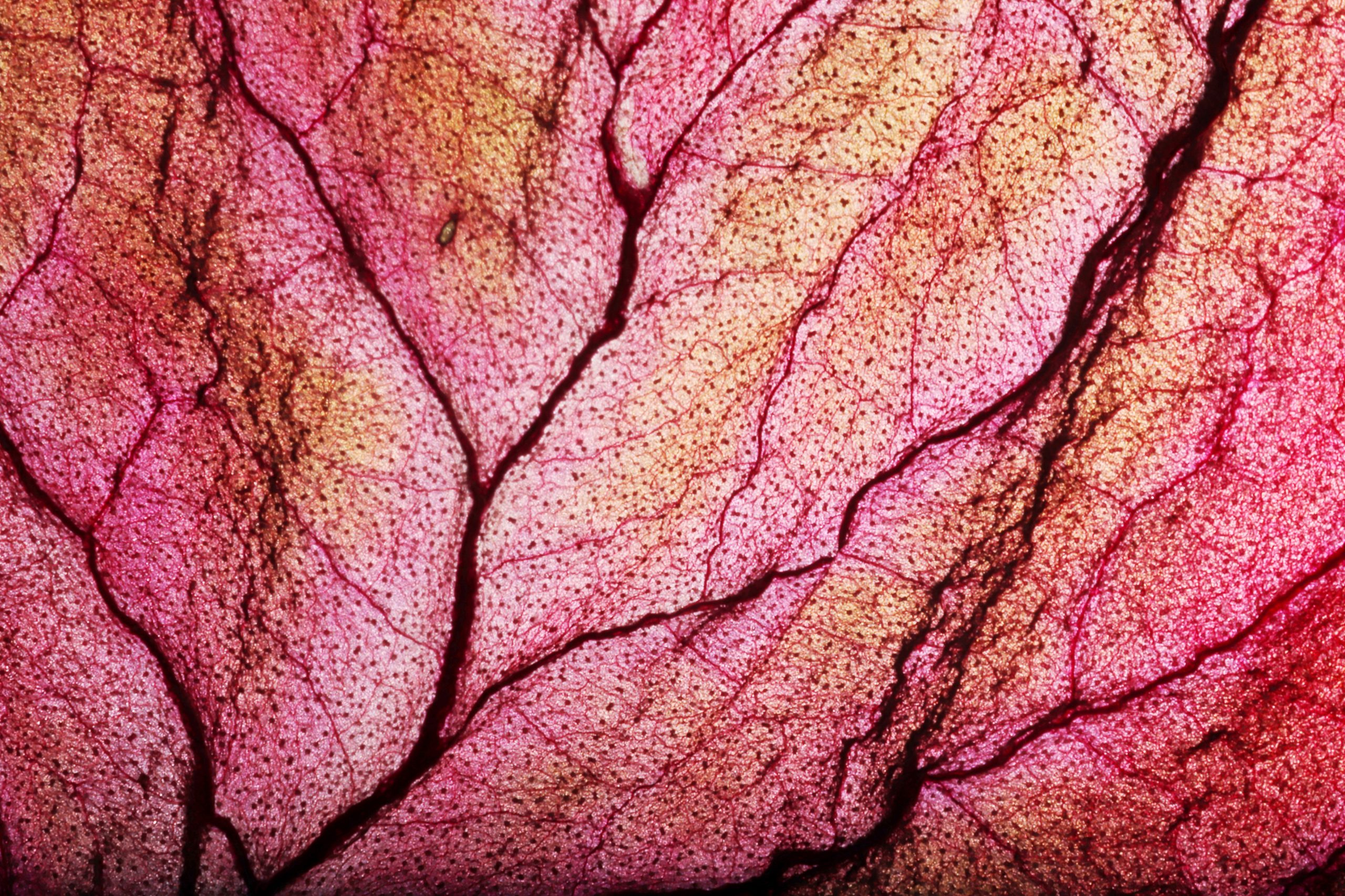 VASCULAR SCREENING