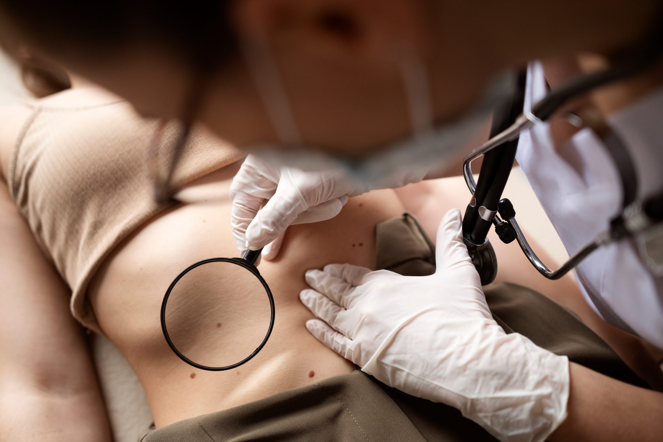 SKIN ANALYSIS